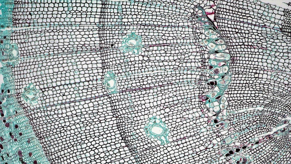 Sharks Lack Bones, Their Skeletons Are Made Entirely Of Cartilage