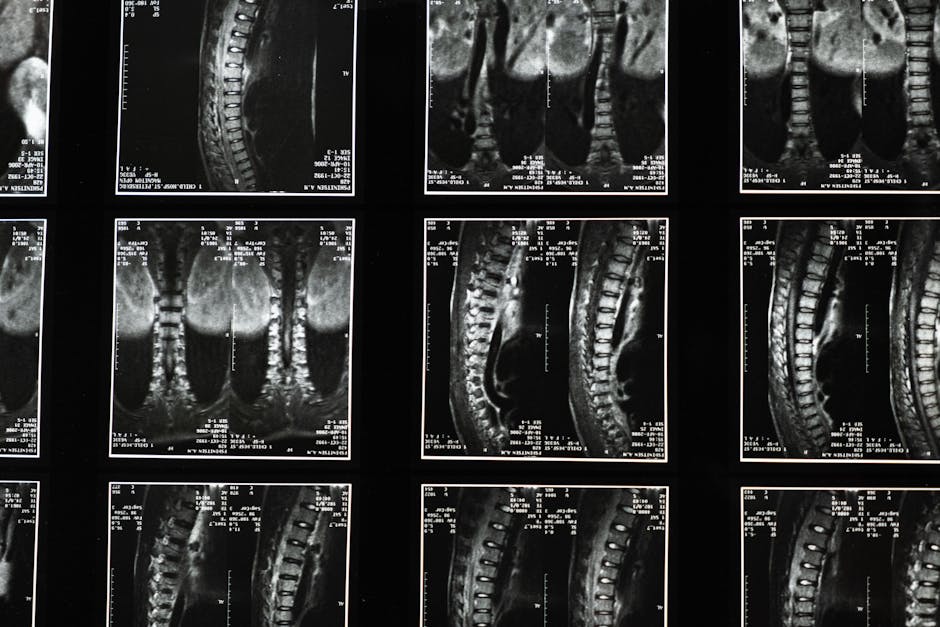Spine