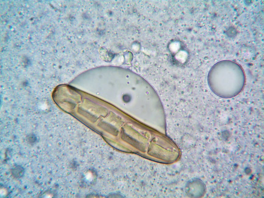 Microorganism